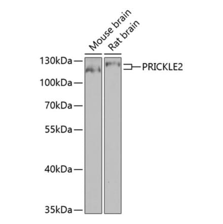 Western Blot - Anti-Prickle 2 Antibody (A10265) - Antibodies.com