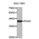 Western Blot - Anti-PGA5 Antibody (A8039) - Antibodies.com