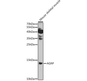 Western Blot - Anti-AGRP Antibody (A10271) - Antibodies.com
