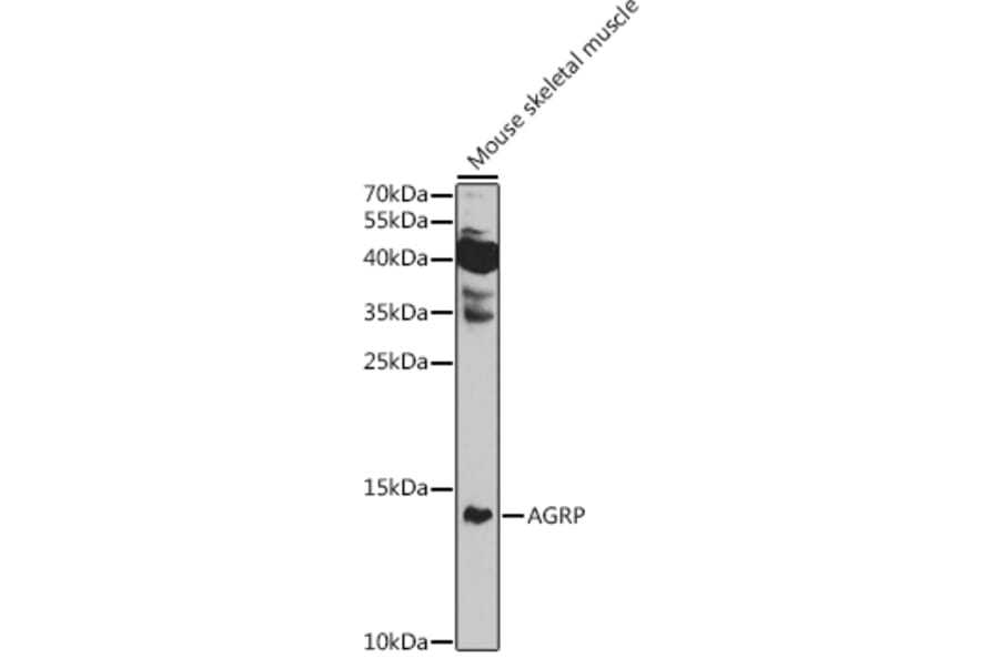 Western Blot - Anti-AGRP Antibody (A10271) - Antibodies.com