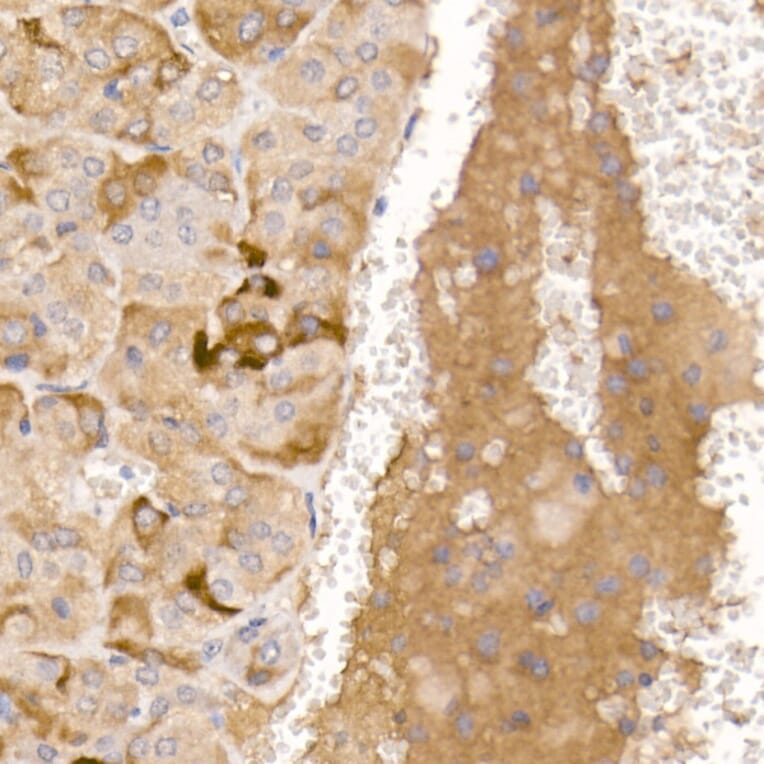 Immunohistochemistry - Anti-AGRP Antibody (A10271) - Antibodies.com