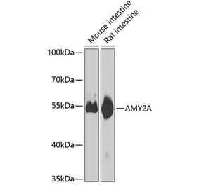 Western Blot - Anti-Pancreatic alpha amylase Antibody (A10272) - Antibodies.com