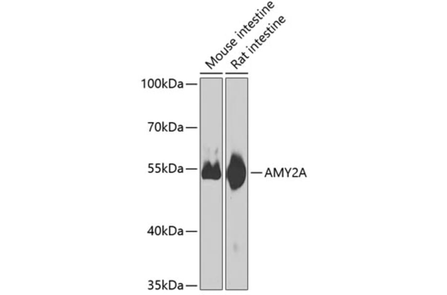 Western Blot - Anti-Pancreatic alpha amylase Antibody (A10272) - Antibodies.com