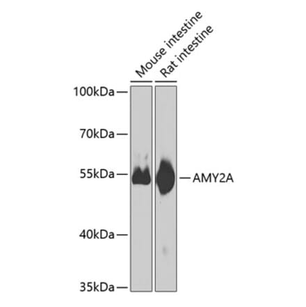 Western Blot - Anti-Pancreatic alpha amylase Antibody (A10272) - Antibodies.com