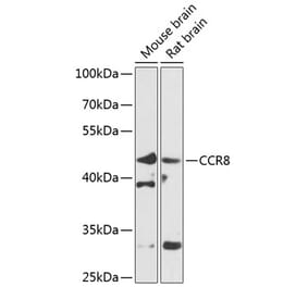 Western Blot - Anti-CCR8 Antibody (A10274) - Antibodies.com