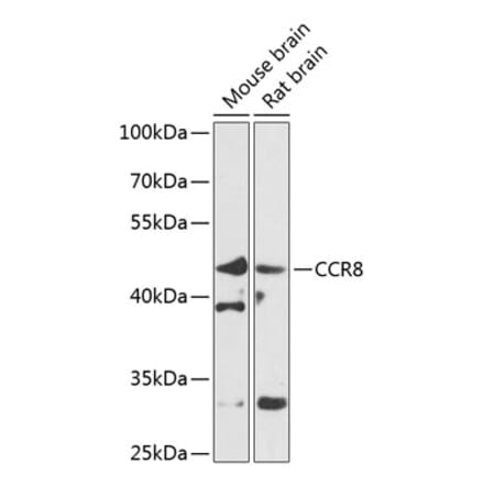 Western Blot - Anti-CCR8 Antibody (A10274) - Antibodies.com