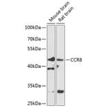 Western Blot - Anti-CCR8 Antibody (A10274) - Antibodies.com