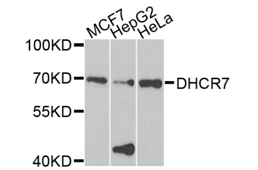 Western Blot - Anti-DHCR7 Antibody (A8049) - Antibodies.com