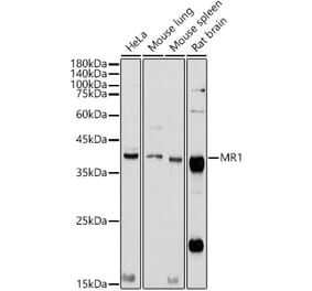 Western Blot - Anti-MR1 Antibody (A10277) - Antibodies.com