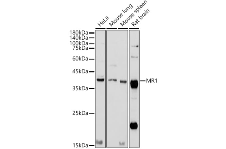 Western Blot - Anti-MR1 Antibody (A10277) - Antibodies.com