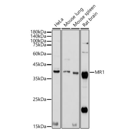 Western Blot - Anti-MR1 Antibody (A10277) - Antibodies.com