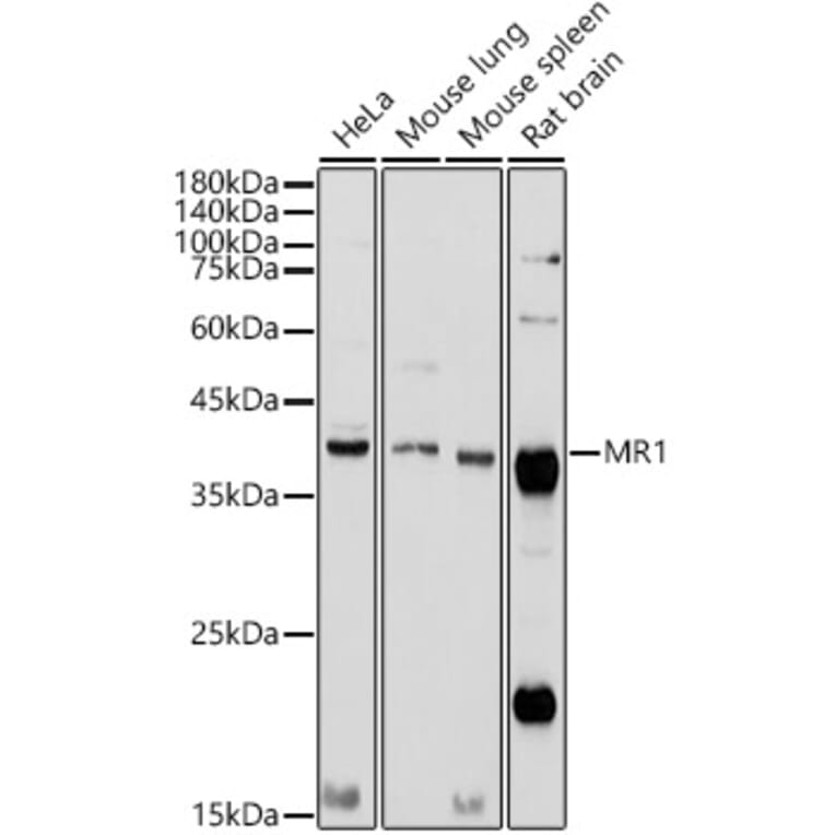 Western Blot - Anti-MR1 Antibody (A10277) - Antibodies.com