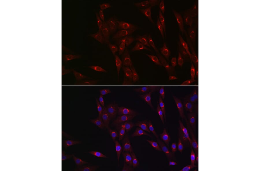 Immunofluorescence - Anti-MR1 Antibody (A10277) - Antibodies.com
