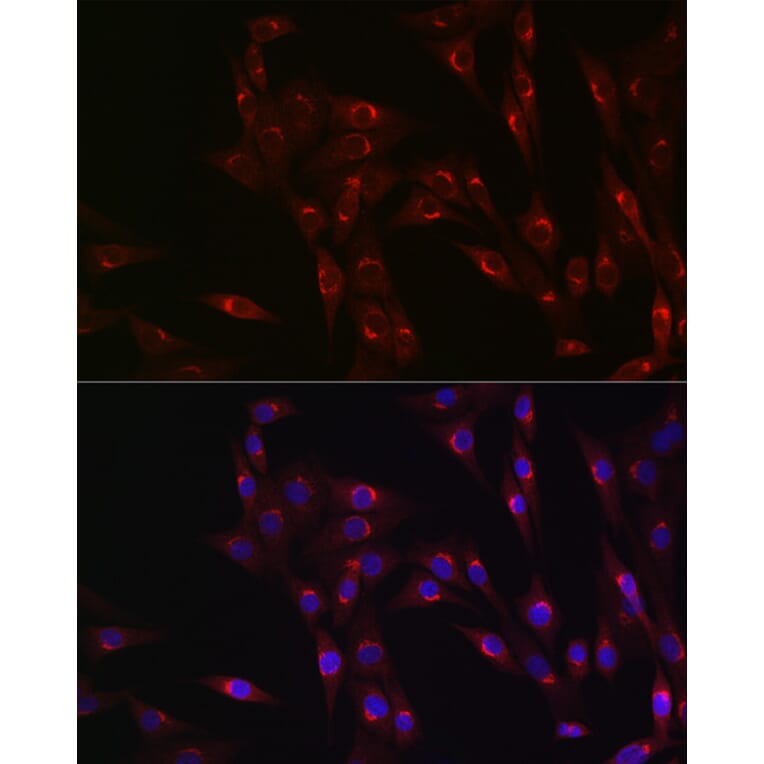 Immunofluorescence - Anti-MR1 Antibody (A10277) - Antibodies.com