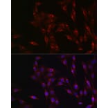 Immunofluorescence - Anti-MR1 Antibody (A10277) - Antibodies.com