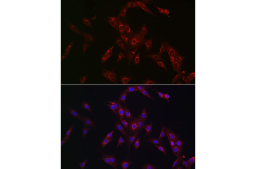 Immunofluorescence - Anti-MR1 Antibody (A10277) - Antibodies.com
