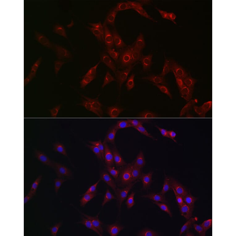 Immunofluorescence - Anti-MR1 Antibody (A10277) - Antibodies.com