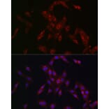 Immunofluorescence - Anti-MR1 Antibody (A10277) - Antibodies.com