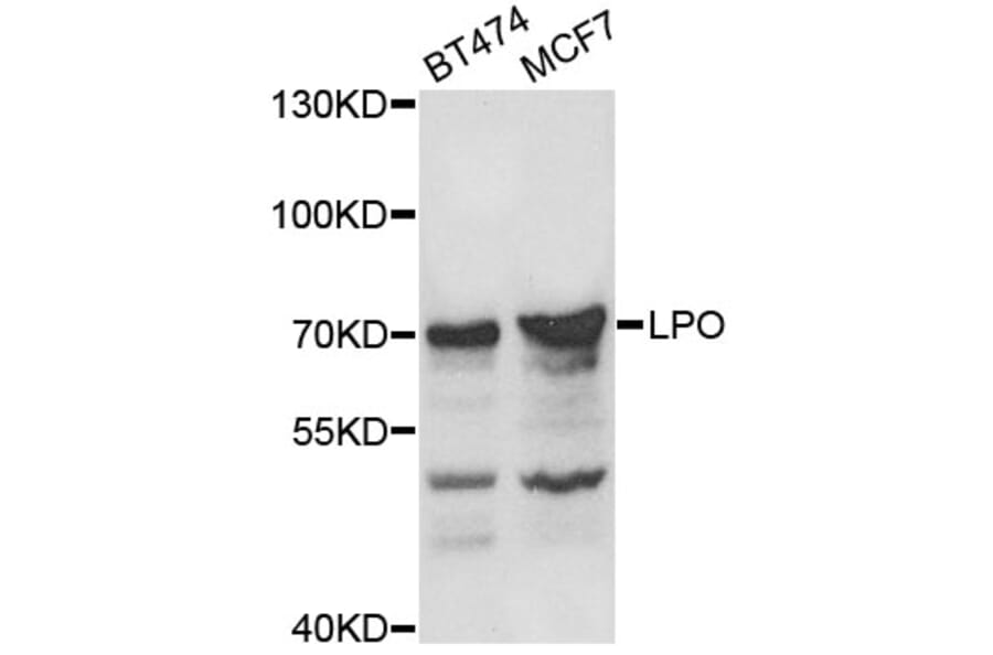 Western Blot - Anti-LPO Antibody (A8053) - Antibodies.com