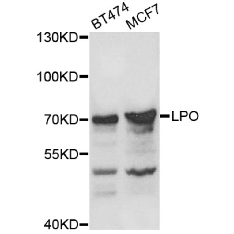 Western Blot - Anti-LPO Antibody (A8053) - Antibodies.com