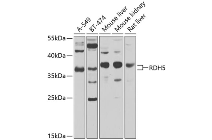 Western Blot - Anti-RDH5 Antibody (A10279) - Antibodies.com