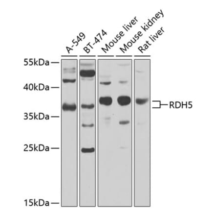 Western Blot - Anti-RDH5 Antibody (A10279) - Antibodies.com