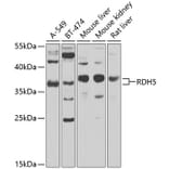 Western Blot - Anti-RDH5 Antibody (A10279) - Antibodies.com