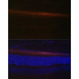 Immunofluorescence - Anti-RDH5 Antibody (A10279) - Antibodies.com