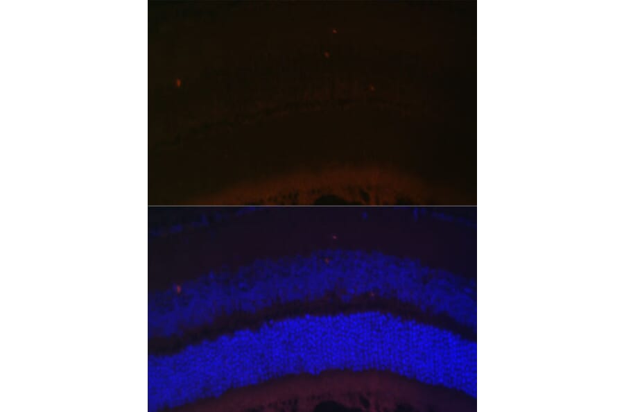 Immunofluorescence - Anti-RDH5 Antibody (A10279) - Antibodies.com