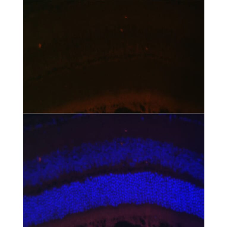 Immunofluorescence - Anti-RDH5 Antibody (A10279) - Antibodies.com