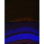 Immunofluorescence - Anti-RDH5 Antibody (A10279) - Antibodies.com