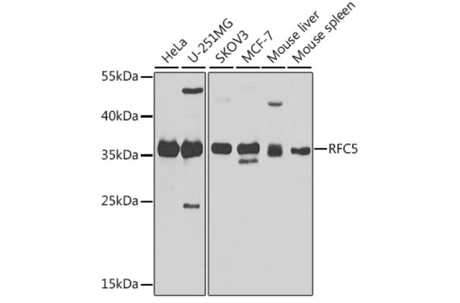 Western Blot - Anti-RFC5 Antibody (A10280) - Antibodies.com
