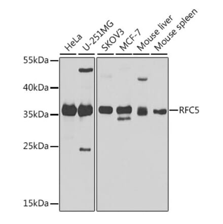 Western Blot - Anti-RFC5 Antibody (A10280) - Antibodies.com