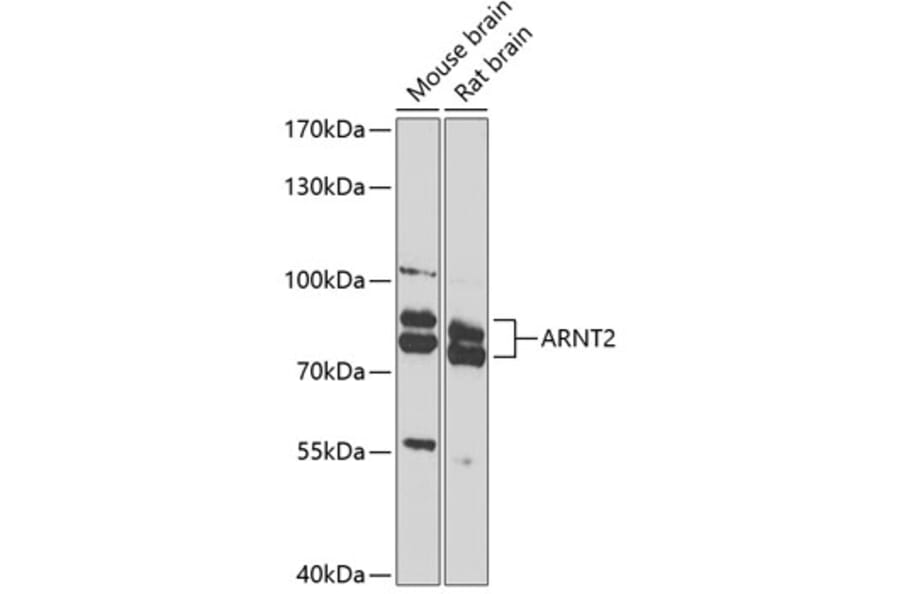 Western Blot - Anti-ARNT2 Antibody (A10281) - Antibodies.com