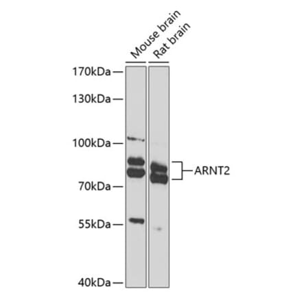 Western Blot - Anti-ARNT2 Antibody (A10281) - Antibodies.com