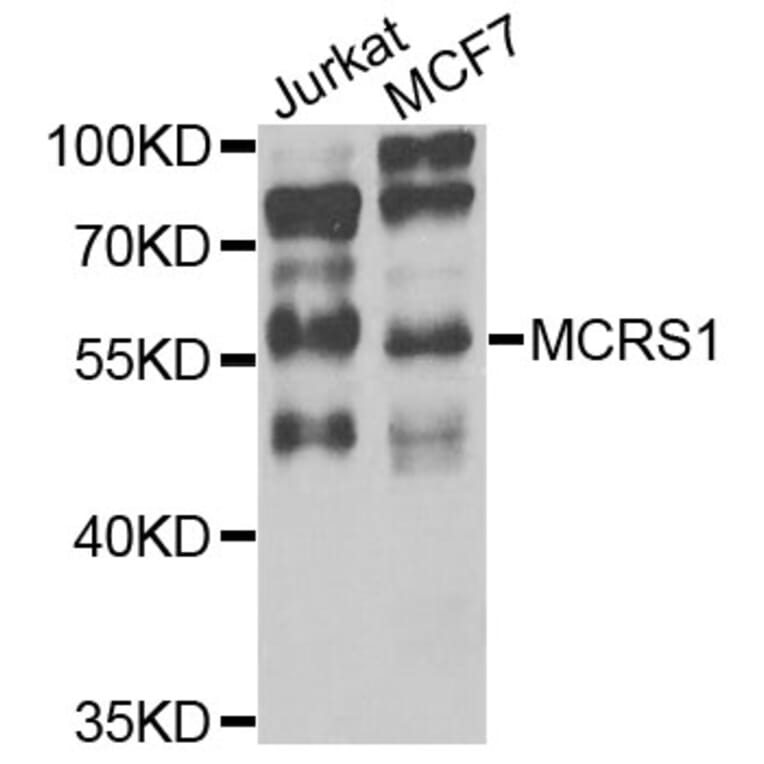 Western Blot - Anti-MCRS1 Antibody (A8061) - Antibodies.com