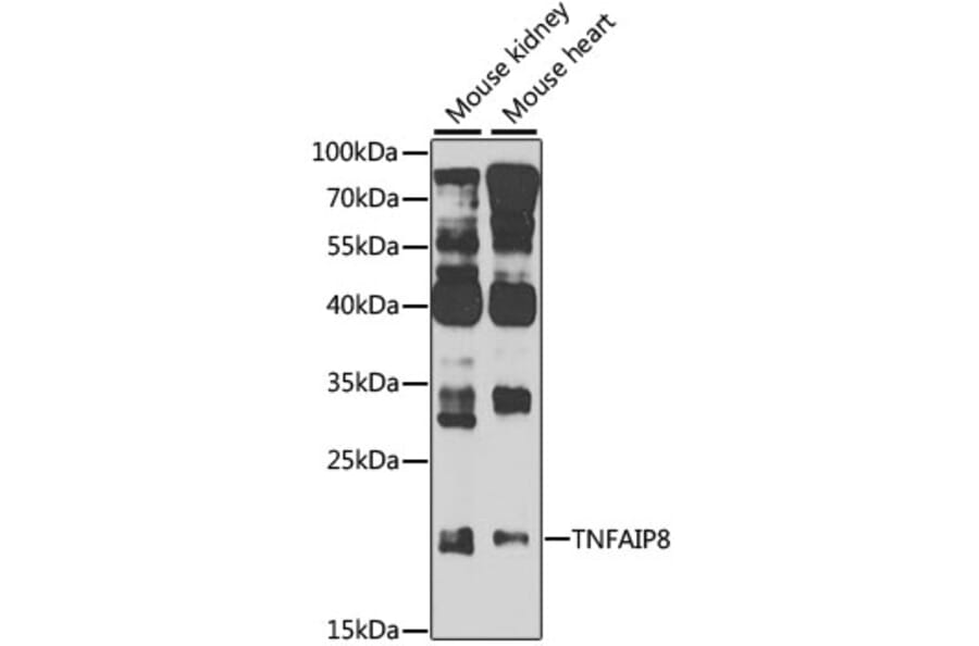 Western Blot - Anti-TNFAIP8 Antibody (A8064) - Antibodies.com