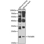 Western Blot - Anti-TNFAIP8 Antibody (A8064) - Antibodies.com