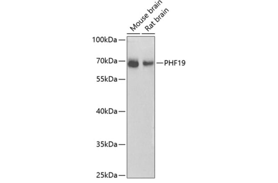 Western Blot - Anti-PHF19 Antibody (A10284) - Antibodies.com