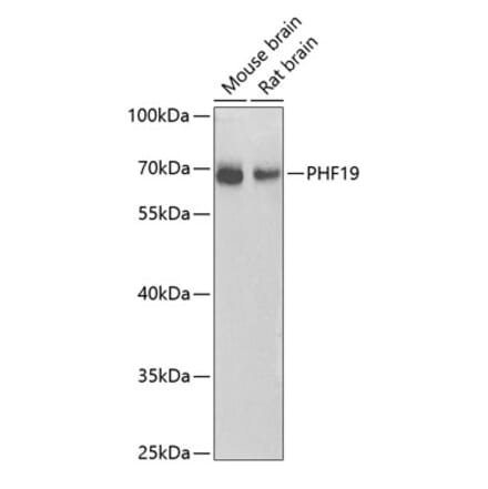 Western Blot - Anti-PHF19 Antibody (A10284) - Antibodies.com
