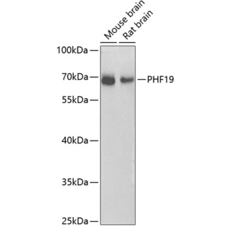 Western Blot - Anti-PHF19 Antibody (A10284) - Antibodies.com