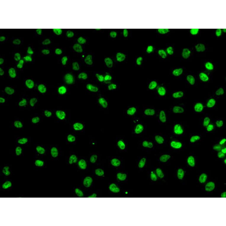 Immunofluorescence - Anti-PHF19 Antibody (A10284) - Antibodies.com