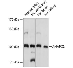 Western Blot - Anti-ANAPC2 Antibody (A10285) - Antibodies.com