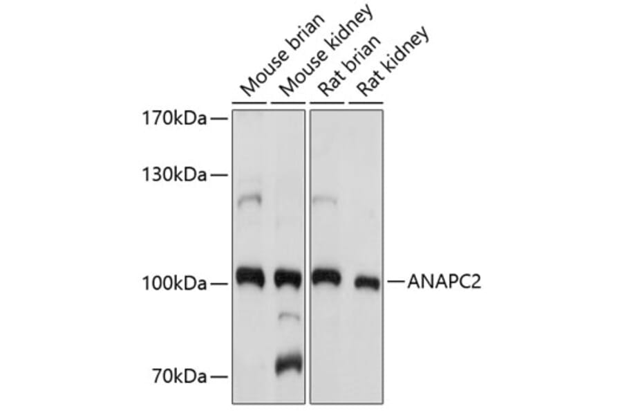 Western Blot - Anti-ANAPC2 Antibody (A10285) - Antibodies.com