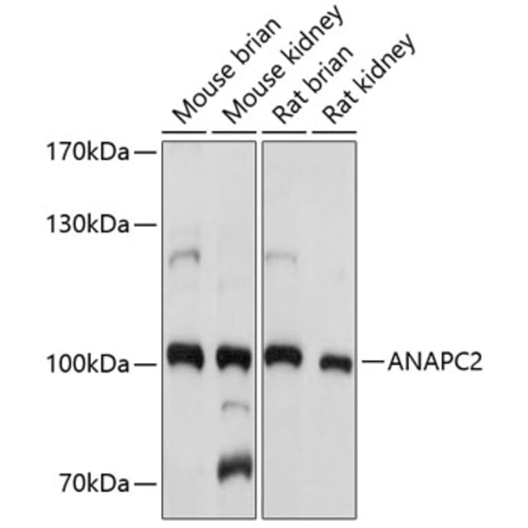 Western Blot - Anti-ANAPC2 Antibody (A10285) - Antibodies.com