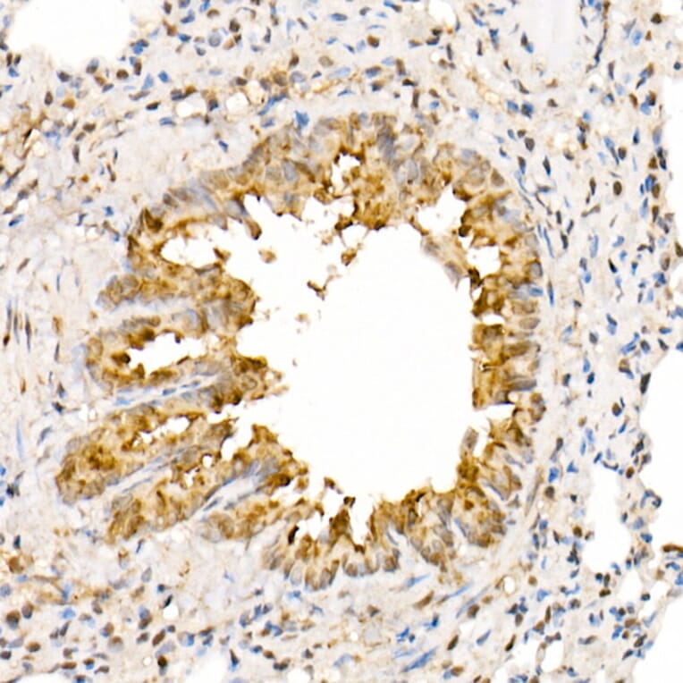 Immunohistochemistry - Anti-ANAPC2 Antibody (A10285) - Antibodies.com