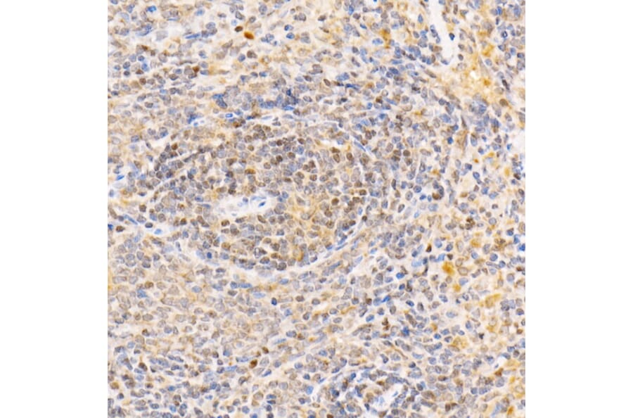 Immunohistochemistry - Anti-ANAPC2 Antibody (A10285) - Antibodies.com