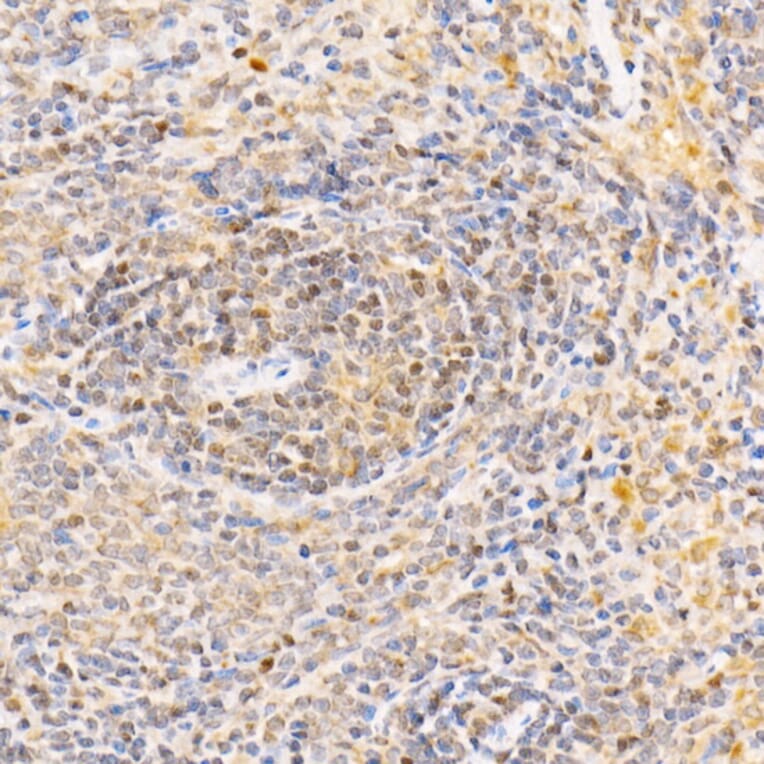 Immunohistochemistry - Anti-ANAPC2 Antibody (A10285) - Antibodies.com