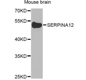 Western Blot - Anti-SERPINA12 Antibody (A8074) - Antibodies.com