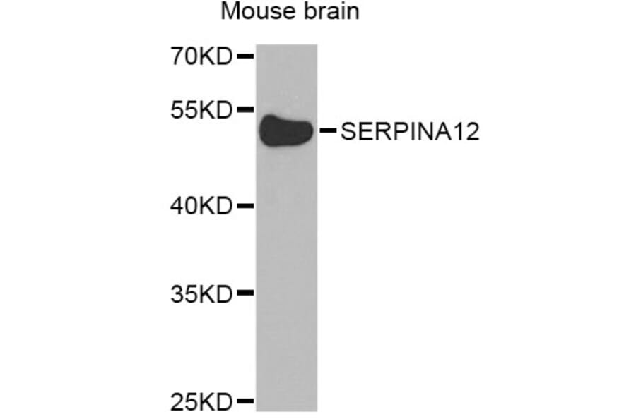 Western Blot - Anti-SERPINA12 Antibody (A8074) - Antibodies.com